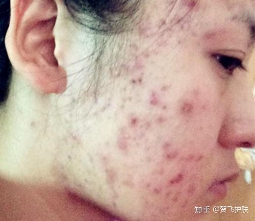 日常護(hù)理指南