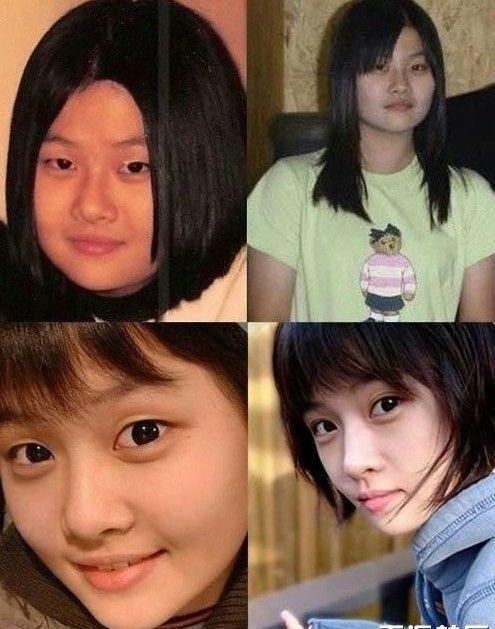 韓國(guó)女星整容，探索背后的故事與真相，韓國(guó)女星整容背后的故事與真相探索