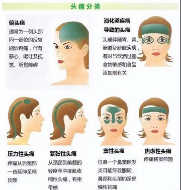 頭痛的快速緩解方法，實(shí)用建議與策略，頭痛快速緩解指南，實(shí)用建議與策略