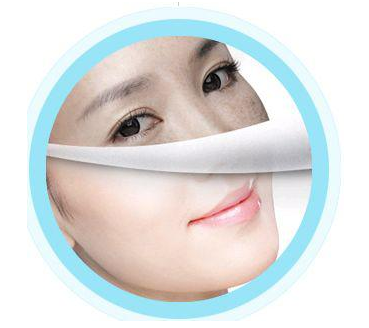 激光美白，探索現(xiàn)代美白新科技，激光美白，現(xiàn)代美白科技的探索之旅