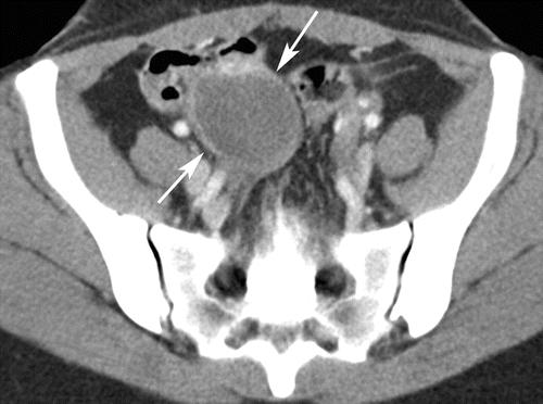 女人下腹疼痛的七大原因及其解析，女人下腹疼痛的七大原因詳解