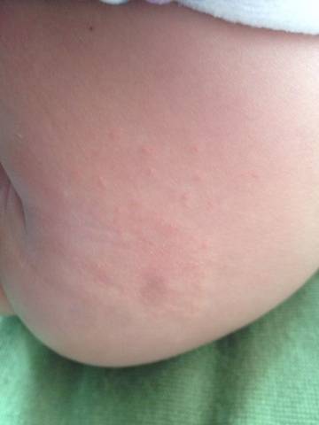 全面解析與應(yīng)對(duì)建議