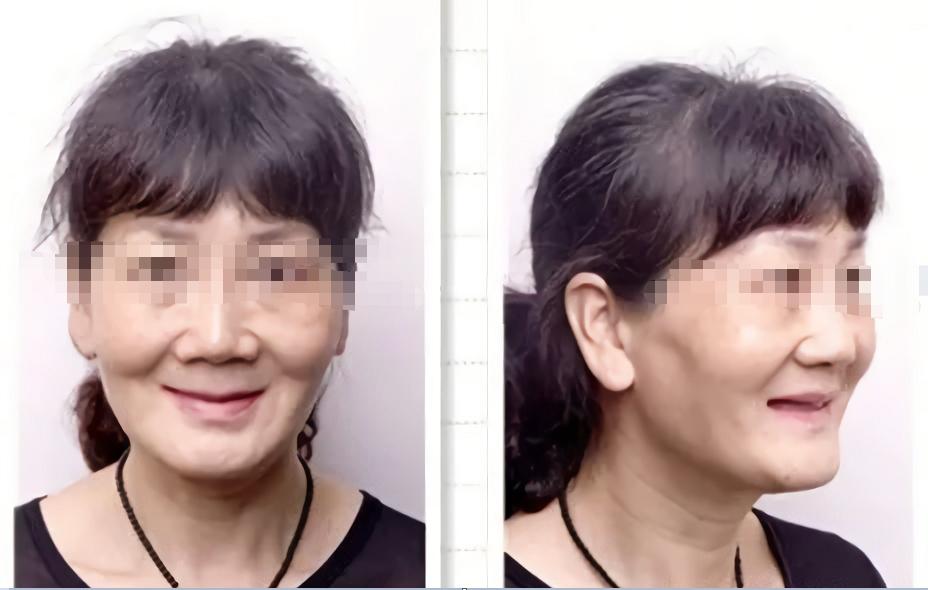 牙齒松動(dòng)怎么辦？教你一招恢復(fù)，牙齒松動(dòng)恢復(fù)妙招，一招解決牙齒松動(dòng)問(wèn)題！