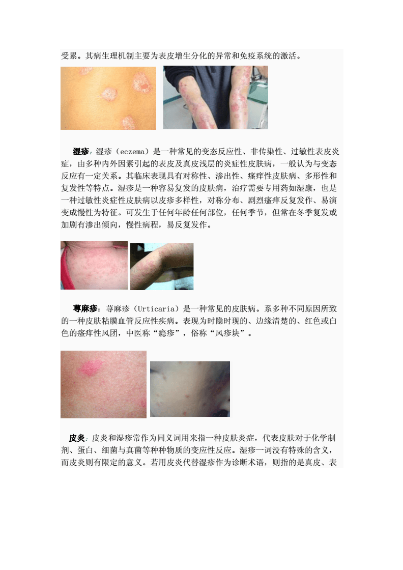 皮膚病對(duì)照大全，癥狀、原因與治療方法，皮膚病癥狀、原因及治療方法對(duì)照大全