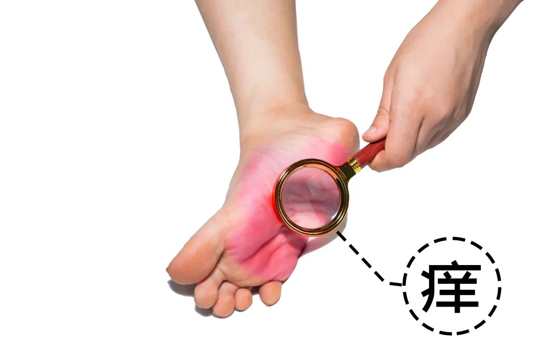 霉菌性陰炎最怕的克星，了解、預(yù)防與治療，霉菌性陰炎的克星，全面解析預(yù)防與治療策略