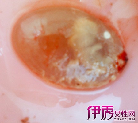 懷孕多久可以藥物流產(chǎn)——全面解析藥物流產(chǎn)時機與注意事項，懷孕早期如何進(jìn)行藥物流產(chǎn)？全面指南解析時機與注意事項