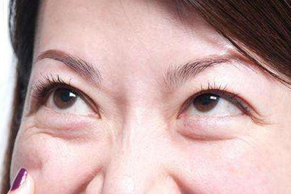 怎樣消除眼袋最有效的方法，消除眼袋的有效方法全解析