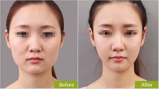 費(fèi)用因素與參考價(jià)位