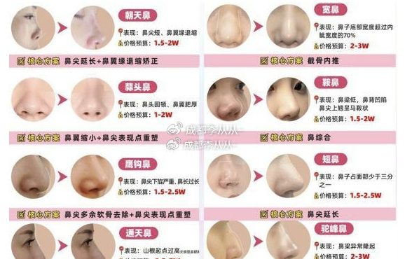 做鼻子整形手術(shù)的費(fèi)用詳解，大概價(jià)格多少？，鼻子整形手術(shù)費(fèi)用詳解，了解鼻子整形大概價(jià)格