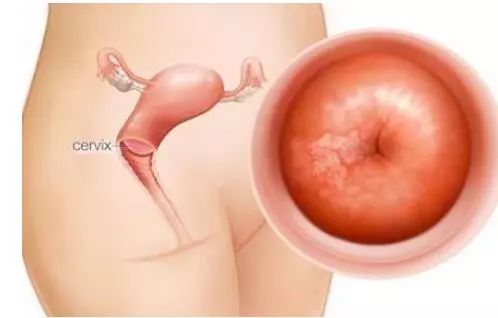 宮頸活檢費用詳解，價格因素與了解途徑，宮頸活檢費用解析，價格因素及了解途徑