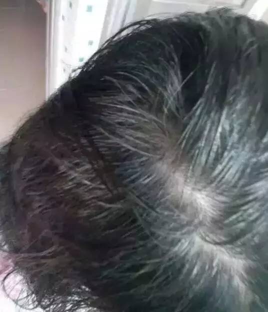 白頭發(fā)怎樣調(diào)理才能變黑——全方位指南，全方位指南，白頭發(fā)如何調(diào)理變黑秘訣