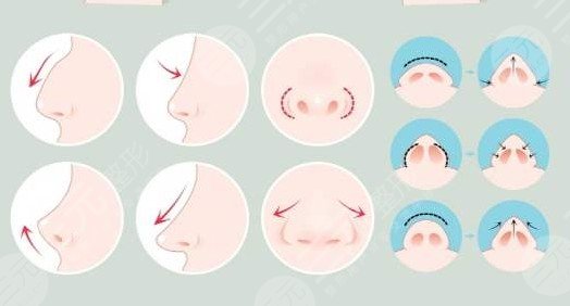 手術(shù)費用解析