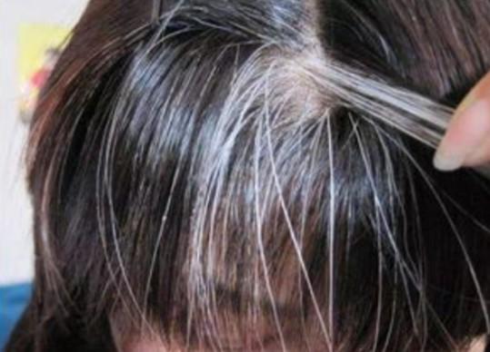 白頭發(fā)怎么調(diào)理變黑發(fā)，全方位指南，全方位指南，白頭發(fā)調(diào)理變黑發(fā)的方法與技巧