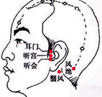 耳朵嗡嗡響是怎么回事？原因解析與應(yīng)對方法，耳朵嗡嗡響的原因解析及應(yīng)對方法