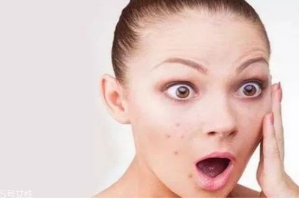 內(nèi)分泌失調(diào)長(zhǎng)痘痘如何調(diào)理，全面解析與應(yīng)對(duì)方法，全面解析，內(nèi)分泌失調(diào)導(dǎo)致的痘痘問(wèn)題及其應(yīng)對(duì)方法