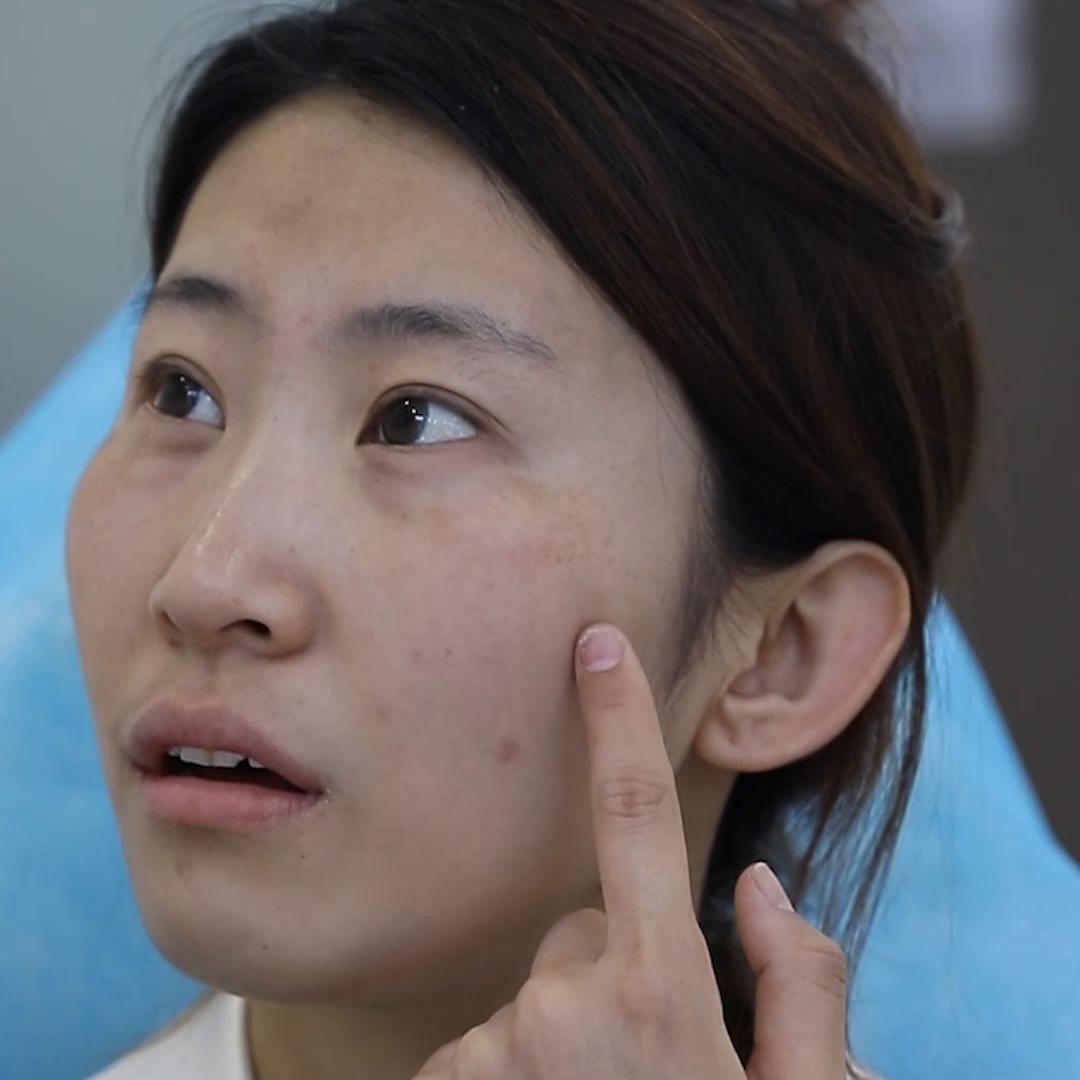 長了黃褐斑還能去掉嗎？——重拾肌膚光彩的秘訣，重拾肌膚光彩，黃褐斑能否去除？揭秘祛斑秘訣！