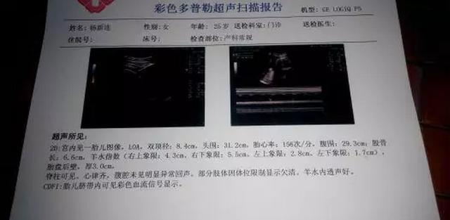 四維單子3秒鐘看男是女，揭秘現(xiàn)代科技下的胎兒性別鑒定技術(shù)，四維彩超3秒識別胎兒性別，揭秘現(xiàn)代科技胎兒性別鑒定技術(shù)揭秘