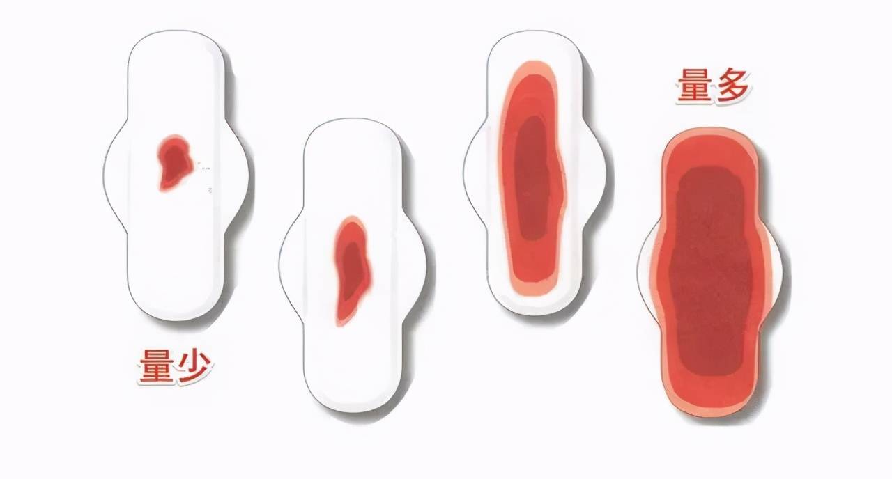 月經(jīng)量少是怎么回事，月經(jīng)量少的原因解析
