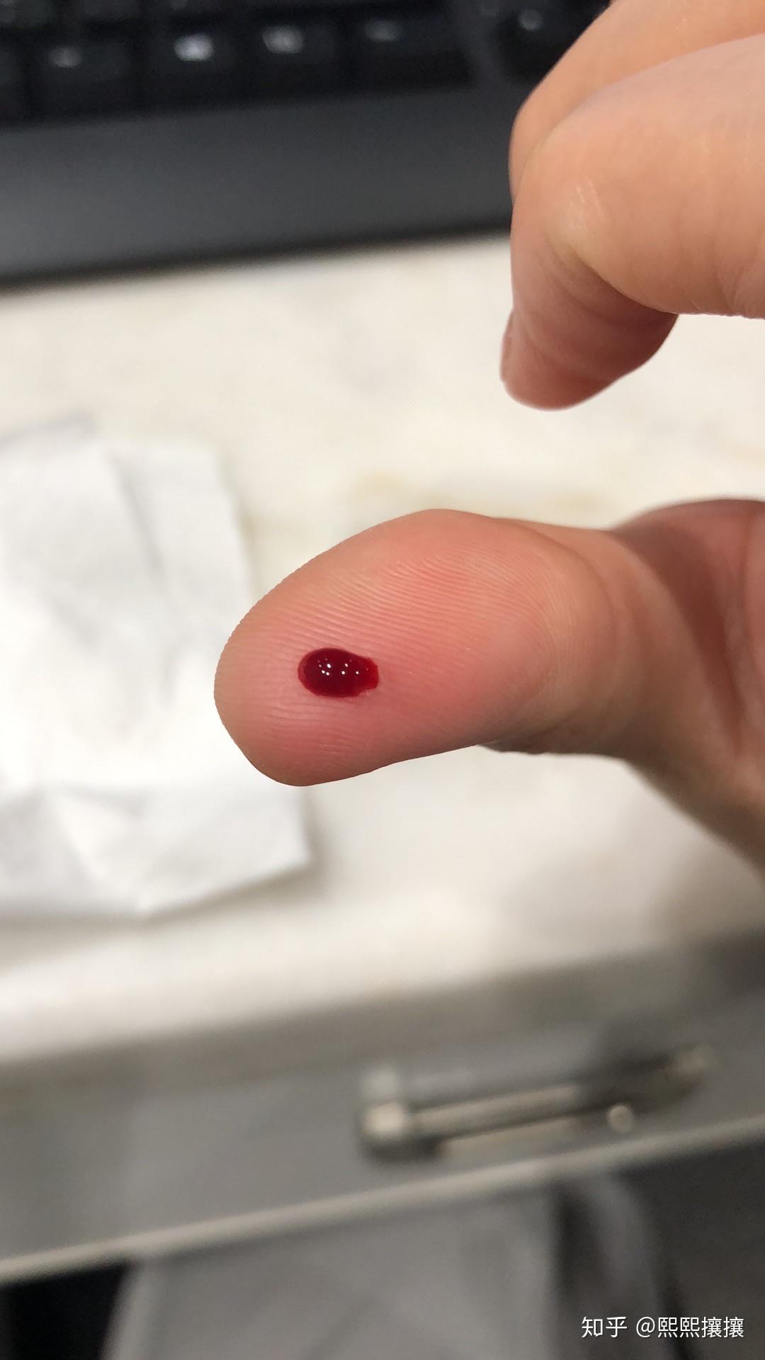 一個手指頭進去了，為何不見血？——深度解析微妙現(xiàn)象背后的原因，一個指頭深入?yún)s未見血，微妙現(xiàn)象背后的深度解析