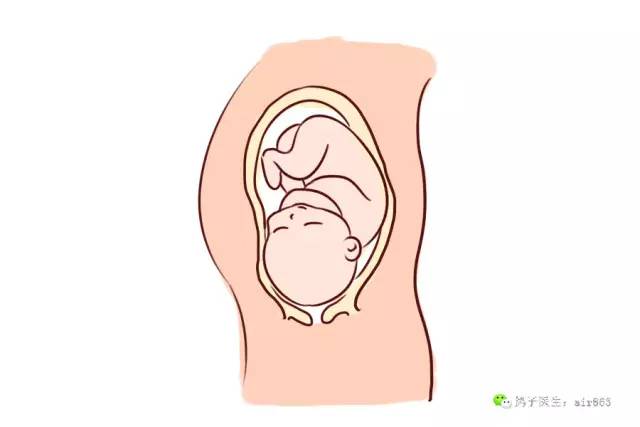 胎停育最明顯的癥狀及其影響，胎停育的癥狀表現(xiàn)及其潛在影響