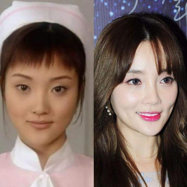 那些整容的女明星，背后的故事與真相揭秘，整容女明星背后的故事與真相大揭秘