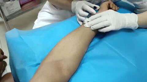 疤痕修復最佳時間，了解并把握修復疤痕的最佳時機，疤痕修復最佳時機解析，把握疤痕修復的最佳時間