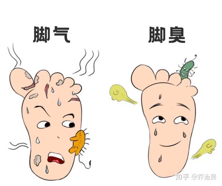 腳臭怎么辦快速去腳臭——全方位解決方案，全方位解決腳臭問題，快速去腳臭的方法與技巧