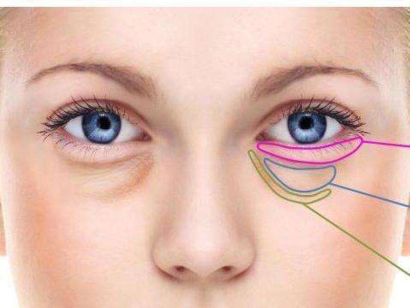 藥店3元錢藥膏去眼袋，告別眼部疲憊的秘密武器，三元神奇藥膏去眼袋，告別眼部疲憊的秘密武器