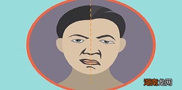 面癱的原因及其影響因素，深度解析，深度解析面癱成因與影響因素