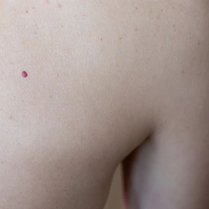 小紅點像血點不痛不癢特別小，探索潛在原因與應(yīng)對之策，小紅點疑似血點，無痛癢感，潛在原因解析與應(yīng)對策略