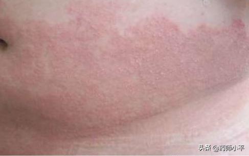 與確診者同住10天卻未被感染，揭秘防疫真相與經驗分享，揭秘防疫真相，與確診者同住10天卻未被感染的經驗分享