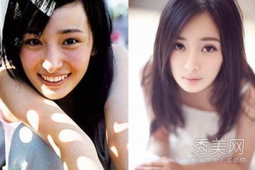 揭秘整容界傳奇，她是整容最成功的女明星之一，揭秘傳奇整容經(jīng)歷，女明星整容巔峰之作，成功重塑美麗傳奇