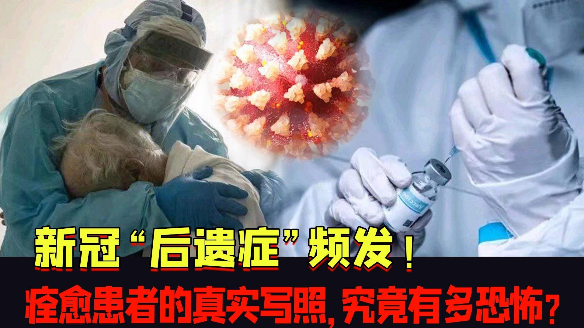 新冠病毒八大后遺癥及其影響，新冠病毒八大后遺癥及其深遠(yuǎn)影響