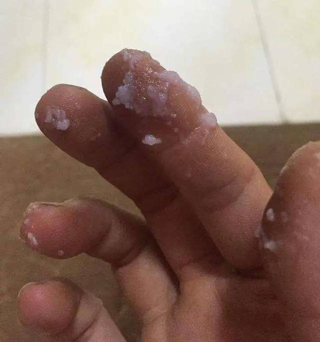 霉菌感染與伴侶之間的關(guān)系，探究霉菌感染是否與老公有關(guān)，霉菌感染與伴侶的關(guān)聯(lián)探究，霉菌感染是否與伴侶有關(guān)？