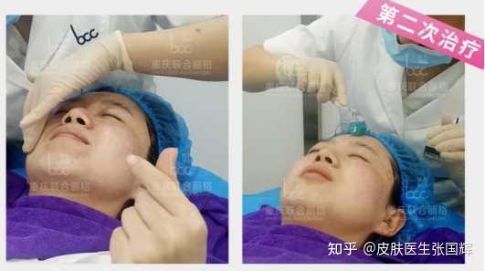 醫(yī)院光子嫩膚價格詳解，多少錢一次？，醫(yī)院光子嫩膚價格解析，費用究竟是多少？