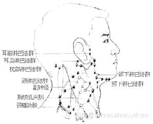 頸部淋巴結自檢手法，了解、掌握與預防，頸部淋巴結自檢方法及預防知識普及