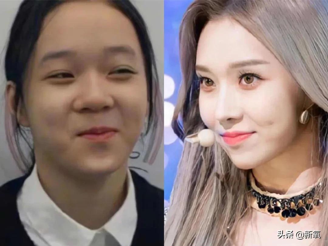 縮小鼻翼手術的風險評估與應對之策，縮小鼻翼手術風險評估及應對策略探討