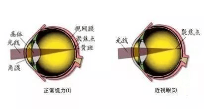 近視，預(yù)防、控制與改善的全方位指南，全方位指南，近視的預(yù)防、控制與改善策略
