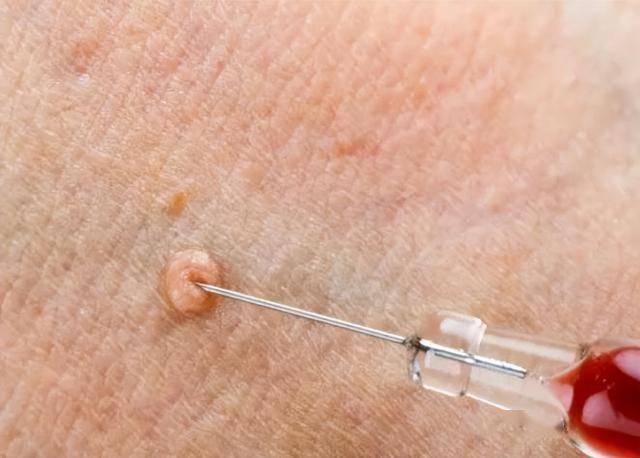 兩個(gè)干凈的人是否會(huì)感染HPV，解析與傳播途徑的重要性，兩個(gè)干凈的人是否會(huì)感染HPV，解析、傳播途徑的重要性探討