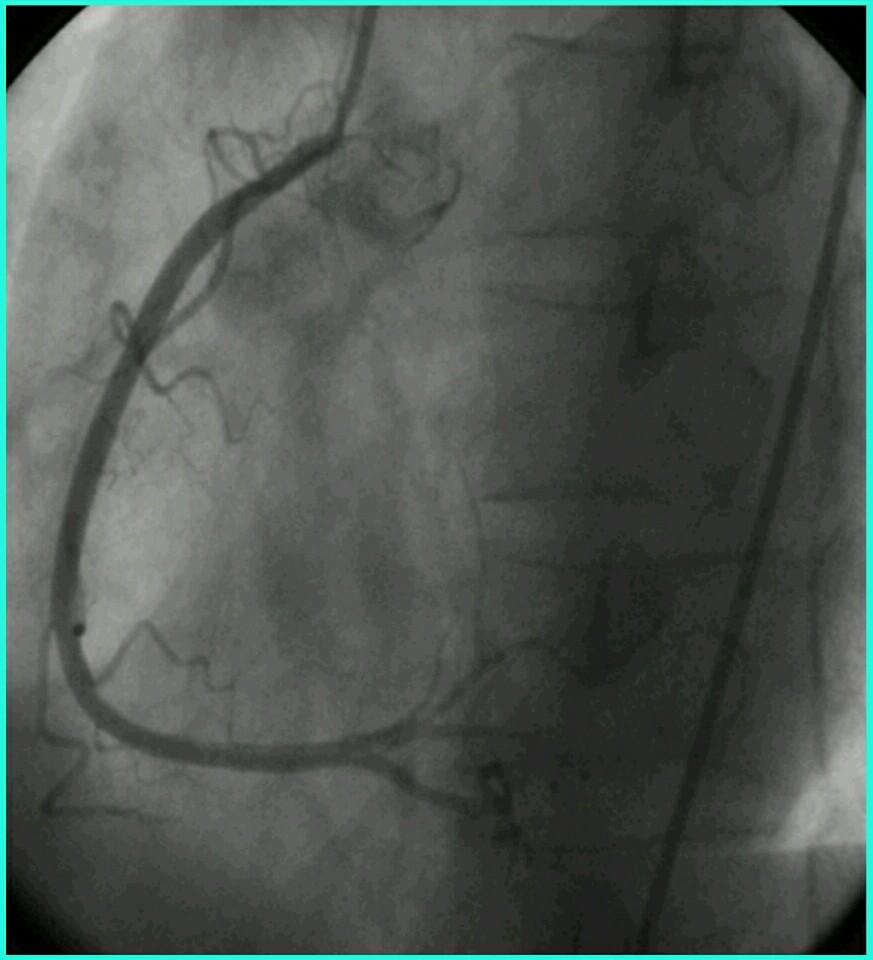 最新資訊，造影檢查費(fèi)用詳解——多少錢(qián)一次？，最新資訊，造影檢查費(fèi)用全面解析——費(fèi)用究竟是多少？