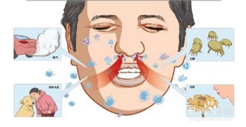 過敏性鼻炎能根治嗎？——深度解析與希望，過敏性鼻炎能否根治？深度探討與希望