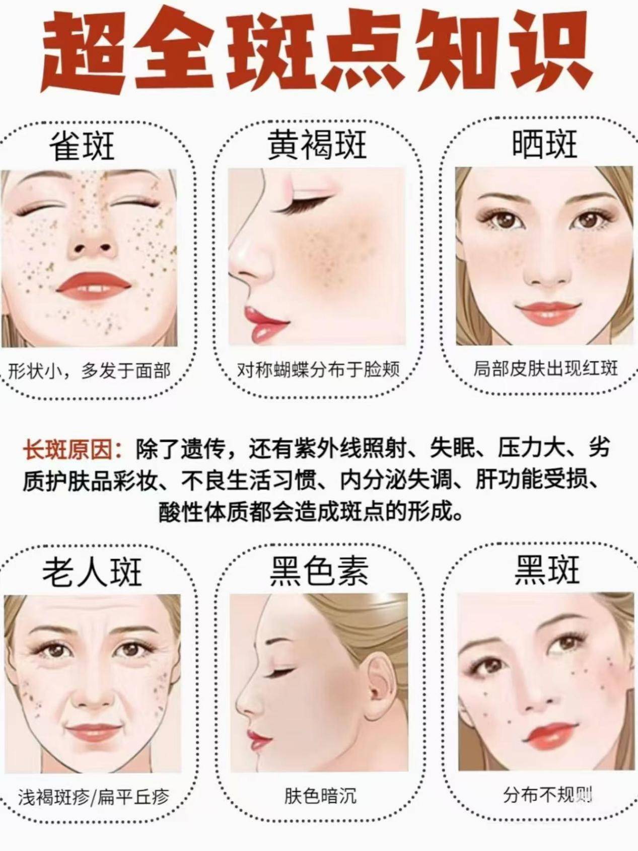 祛斑方法哪種效果好？——全面解析最佳祛斑途徑，全面解析，哪種祛斑方法最有效？揭秘最佳祛斑途徑。