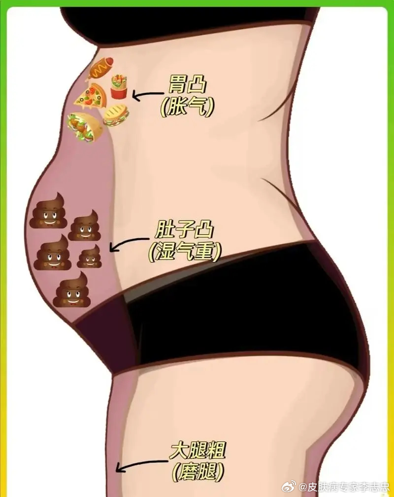 肚子大是濕氣重的原因嗎？解析濕氣與腹部肥胖的關(guān)系，肚子大是濕氣所致嗎？濕氣與腹部肥胖的關(guān)聯(lián)解析