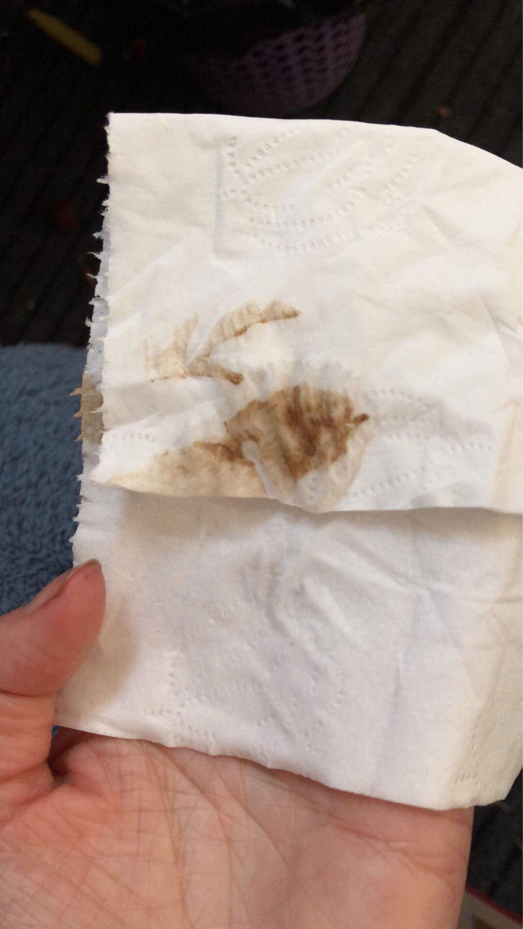 懷孕后流褐色血是好事嗎？解讀孕期出血現(xiàn)象，孕期出血現(xiàn)象解讀，流褐色血是好事還是警示？