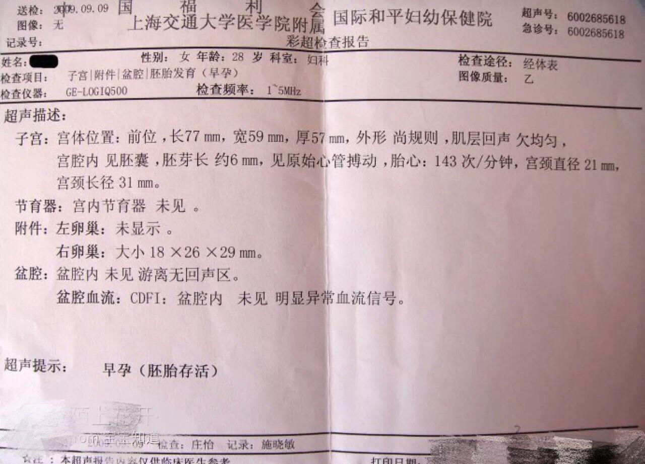 孕囊算不算一條生命，深度解析胚胎早期發(fā)展階段，孕囊與胚胎早期發(fā)展階段，深度解析一條生命的誕生