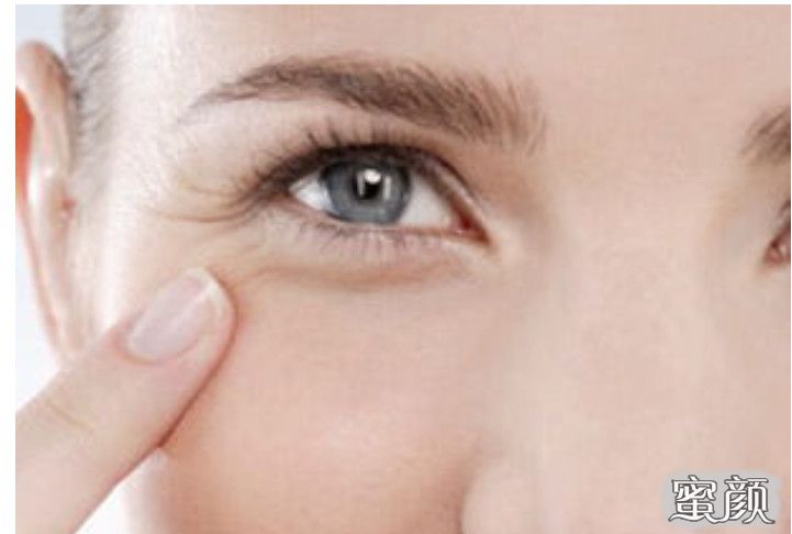 如何有效去除魚尾紋皺紋——你的抗皺指南，抗皺寶典，魚尾紋皺紋的有效去除方法