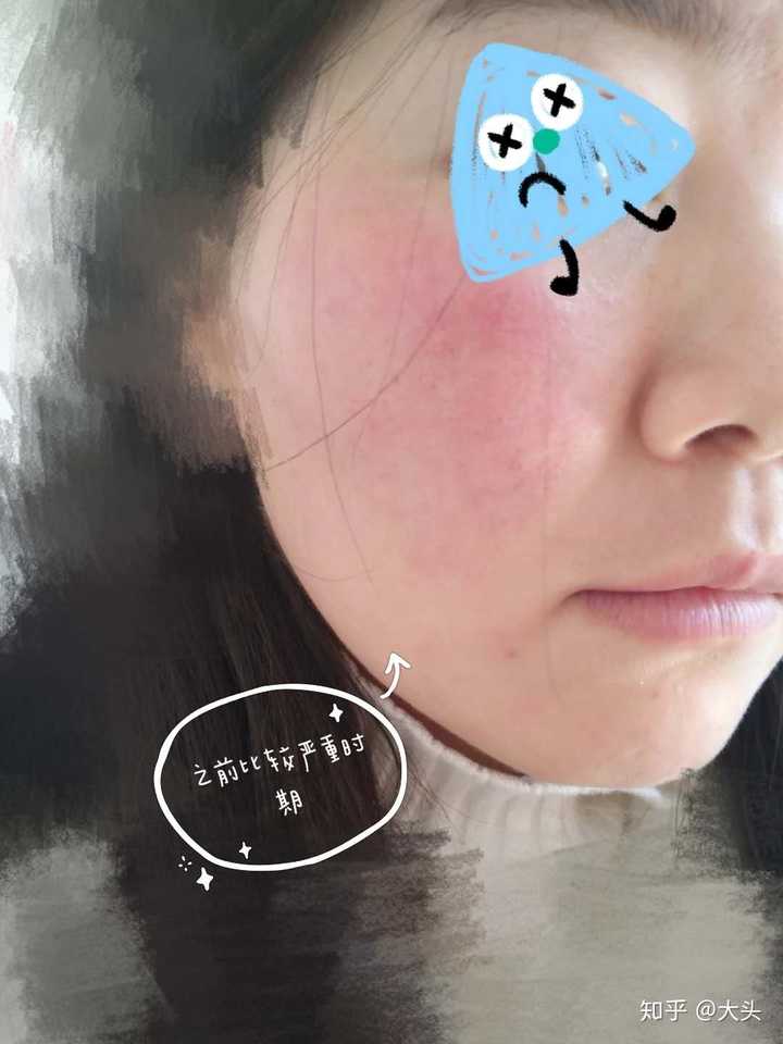 修復(fù)敏感肌，重塑健康肌膚——敏感肌怎樣修復(fù)成正常肌膚的秘訣，敏感肌修復(fù)指南，重塑健康肌膚的秘訣