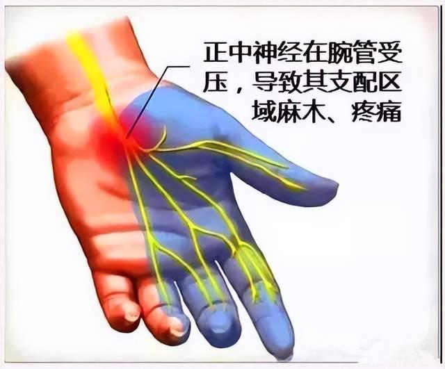 類風(fēng)濕哪個手指先疼，早期癥狀與預(yù)防策略，類風(fēng)濕手指疼痛初探，早期癥狀、預(yù)防策略及哪個手指先受影響