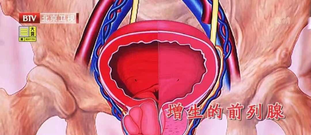 提肛運(yùn)動(dòng)，一種值得關(guān)注的健康鍛煉方式，提肛運(yùn)動(dòng)，一種不可忽視的健康鍛煉方法