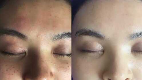 去除臉上的斑小妙招，打造無(wú)瑕肌膚的秘訣，打造無(wú)瑕肌膚秘訣，去除臉上斑點(diǎn)的實(shí)用小妙招